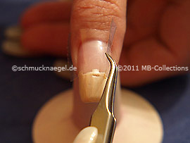 Pinzette und durchsichtiges Klebeband
