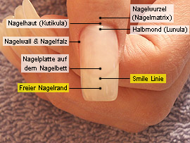 Freier Nagelrand und Smile Linie